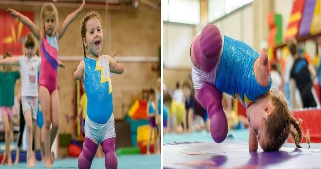Menina de 5 anos vira ginasta depois de perder os quatro membros e supera qualquer expectativa