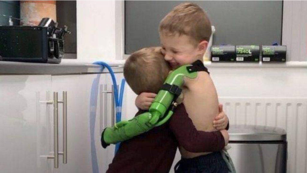 Menino de 5 anos ganha prótese de braço e abraça irmão pela primeira vez